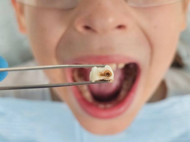 Best Pediatric Emergency Dentist in Concord, MO